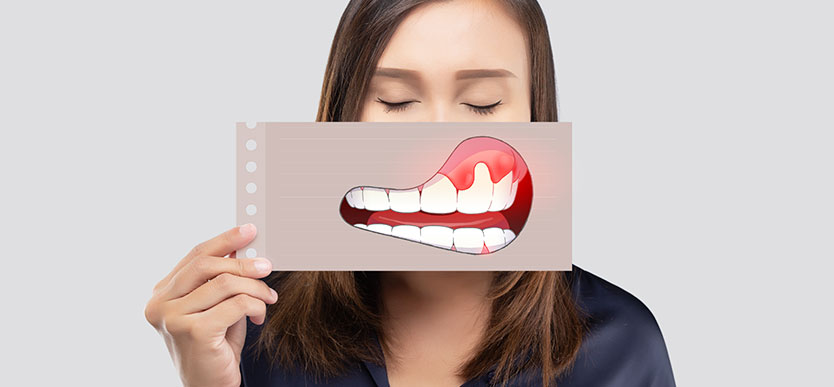 Oral Cancer Treatment In Siliguri